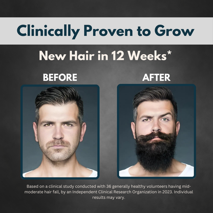 Beard Oil - Natural Herbal Formula for Thicker, Healthier Beard Growth