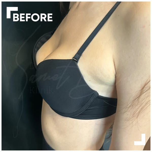 B-Tone+ Shaping Therapy Oil Offer