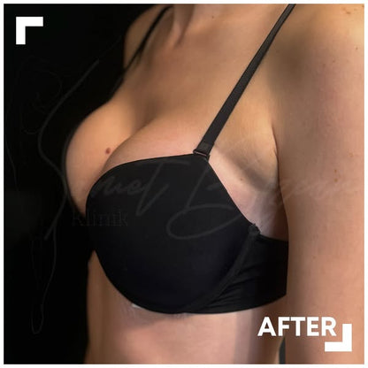 B-Tone+ Shaping Therapy Oil Offer